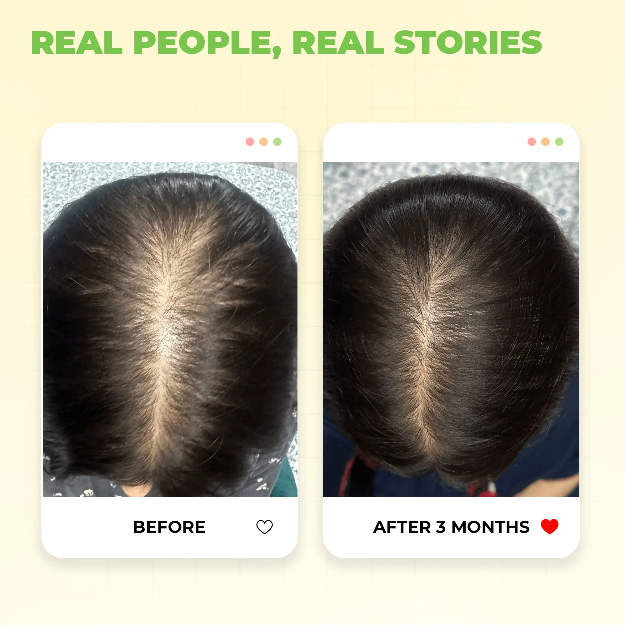 Extra Virgin Coconut Oil For Winters - Image 6