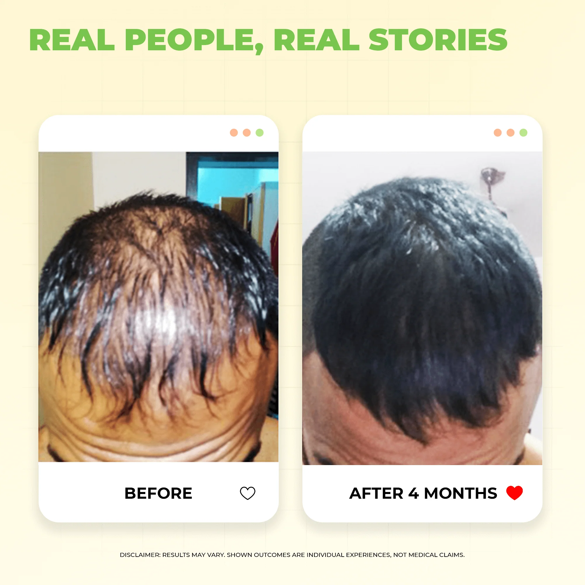 Hard Water Hair Revival Kit for Hairfall & Dryness - Image 3