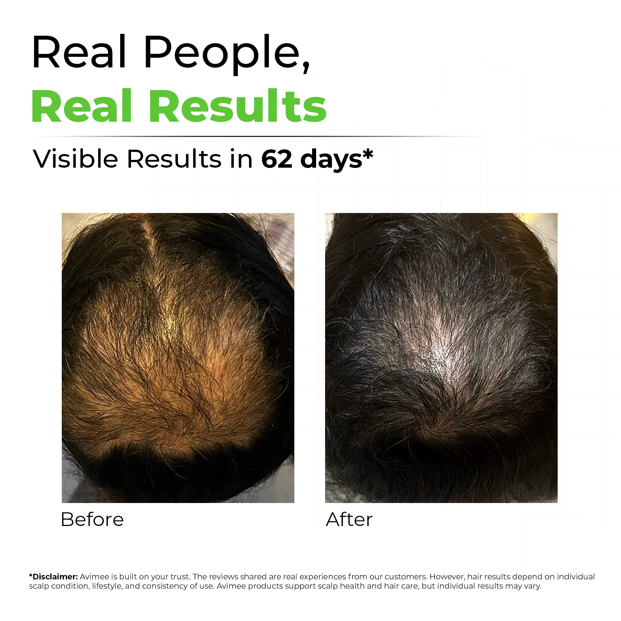Keshpallav Hair Oil for Hair Growth with 5% Nansyl & Rosemary Extracts - Image 3
