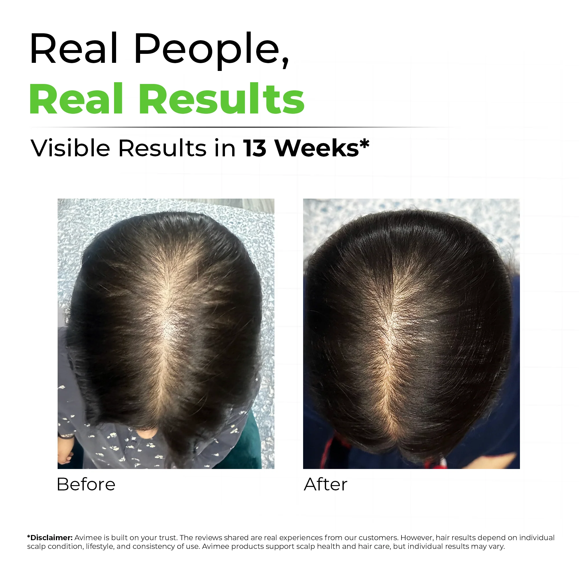 Rosemary Hair Oil for Hair Growth - Image 3